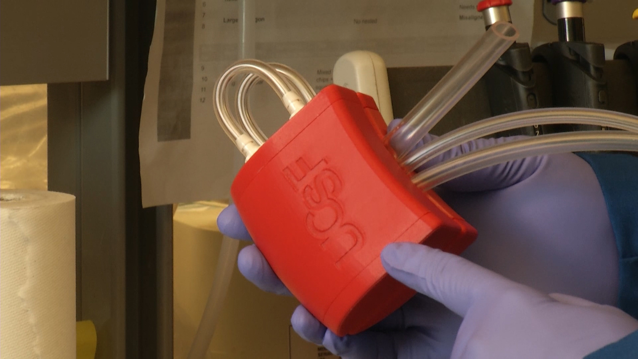 Building an artificial kidney Medicine's next big thing?
